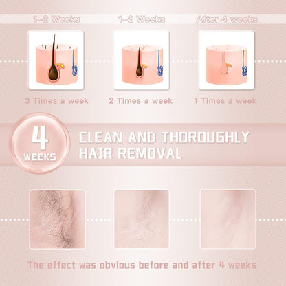 IPL Laser Hair Removal Device for Women and Men